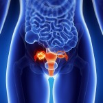 uterus-ovaries